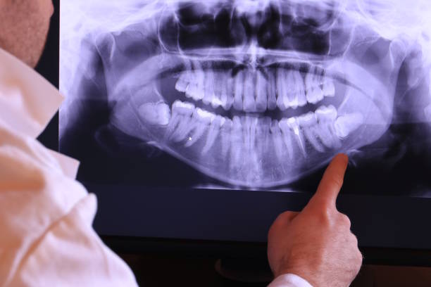 Best Emergency Wisdom Teeth Removal in Eudora, AR